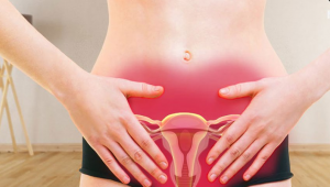 Виды нарушений менструального цикла