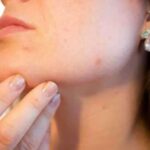 Що можна дізнатися про свій організм за проблемами зі шкірою