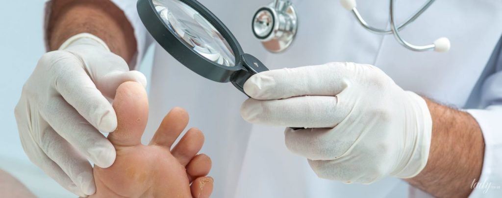 Грибковая инфекция ногтевой пластины: как выявить и как лечить?