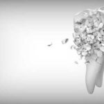 Навіщо потрібно фторувати воду і що буде з вашими зубами якщо цього не робити