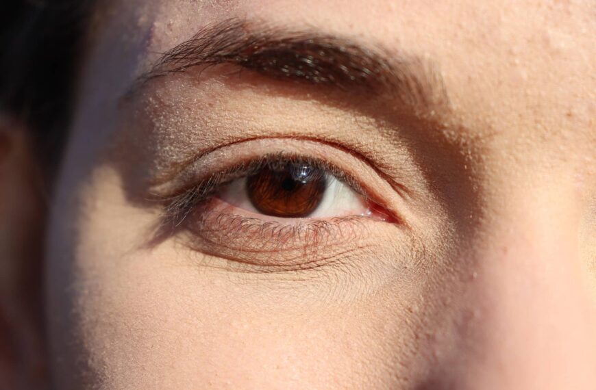 Замість патчів – плитка шоколаду: несподіваний спосіб боротьби з темними колами під…