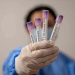 ВООЗ розвінчує міфи про хантавірус: чи чекати нової пандемії?